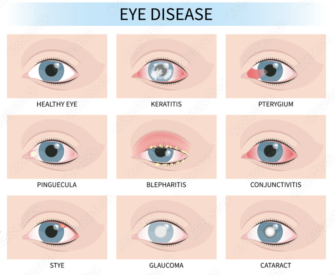 why-does-my-eye-hurt-when-i-blink